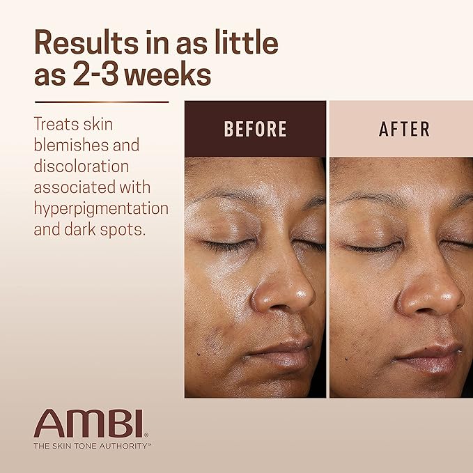 Ambi Fade Cream Oily Skin